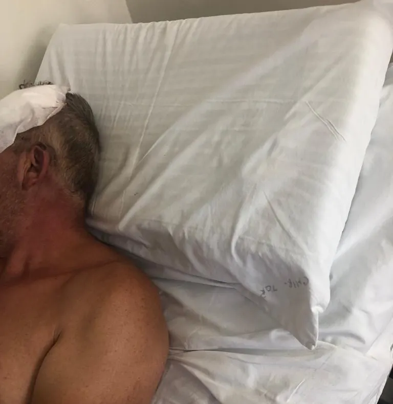 Încă un angajat al unei primării din judeţ a fost bătut cu bestialitate