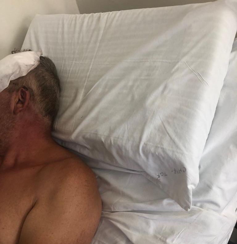 Încă un angajat al unei primării din judeţ a fost bătut cu bestialitate