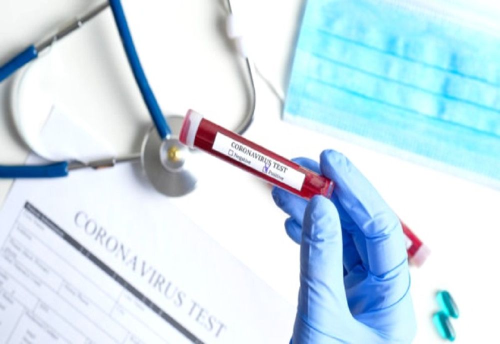 COVID-19. Situație alarmantă! Un sfert dintre testele efectuate în ultima zi sunt pozitive!