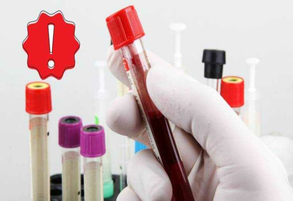 DEPUTAȚII RESPING PROPUNEREA CA MINORII CU VÂRSTA DE MINIM 17 ANI SĂ POATĂ DONA SÂNGE