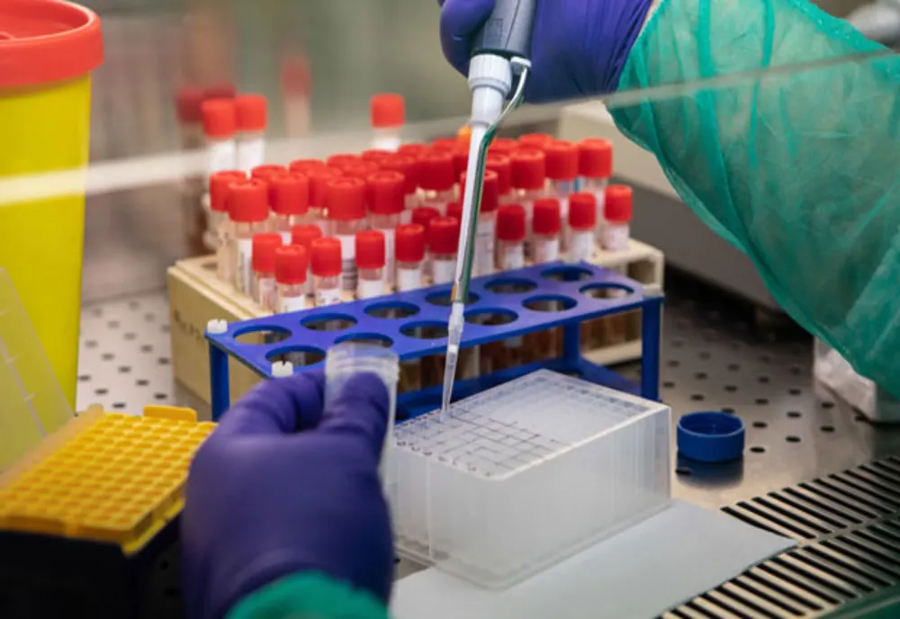  Zece laboratoare din Constanța și Tulcea, pentru studiul național de seroprevalență