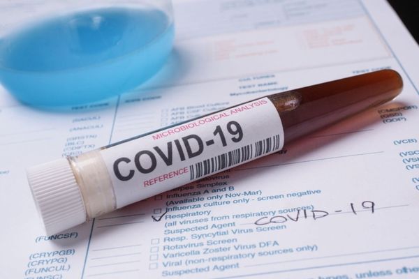 Bilanț coronavirus 31 august: 755 de cazuri noi, 43 de decese și 506 persoane internate la ATI