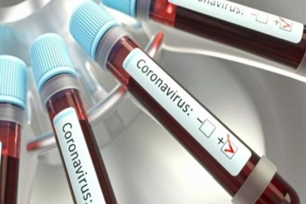 Bilanț coronavirus 17 septembrie: 1.679 de cazuri noi, 27 de decese și 460 persoane internate la ATI