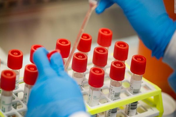 A crescut capacitatea de testare pentru COVID în România