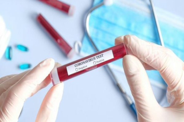 Bilanț coronavirus 5 noiembrie: 9.714 cazuri noi și 121 decese