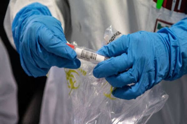 Bilanț coronavirus: 4.729 de cazuri noi și 121 de decese 