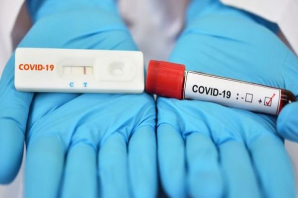 GERMANIA: Test PCR negativ la intrarea în țară pentru toți călătorii