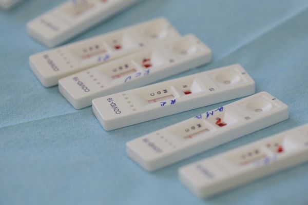 Care este gradul de pozitivare pentru testele COVID. Anunțul Ministerului Sănătăţii