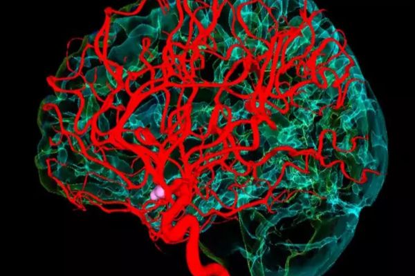 Studiu. S-a descoperit o metodă prin care se poate diagnostica boala Parkinson înainte de apariția simptomelor