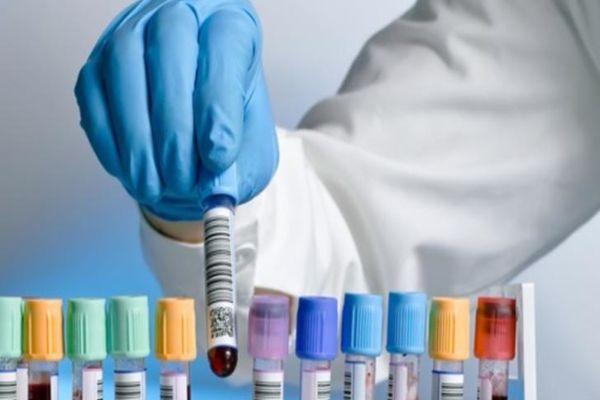 PALMED: PACIENȚII PLĂTESC ANALIZE MEDICALE PENTRU CĂ FONDURILE CNAS SE EPUIZEAZĂ ÎN PRIMELE ZILE ALE LUNII