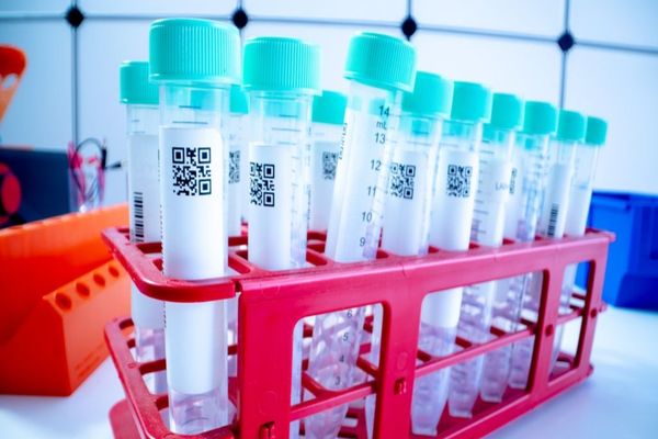 TESTARE GRATUITĂ ȘI ANONIMĂ PENTRU HIV ȘI HEPATITE LA TREI SPITALE DIN BUCUREȘTI