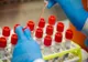 Coronavirus în Tulcea: 212 de teste,  43 de cazuri